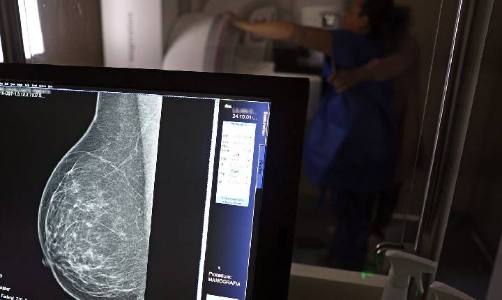 Nova lei reforça direito a três folgas por ano para exames preventivos