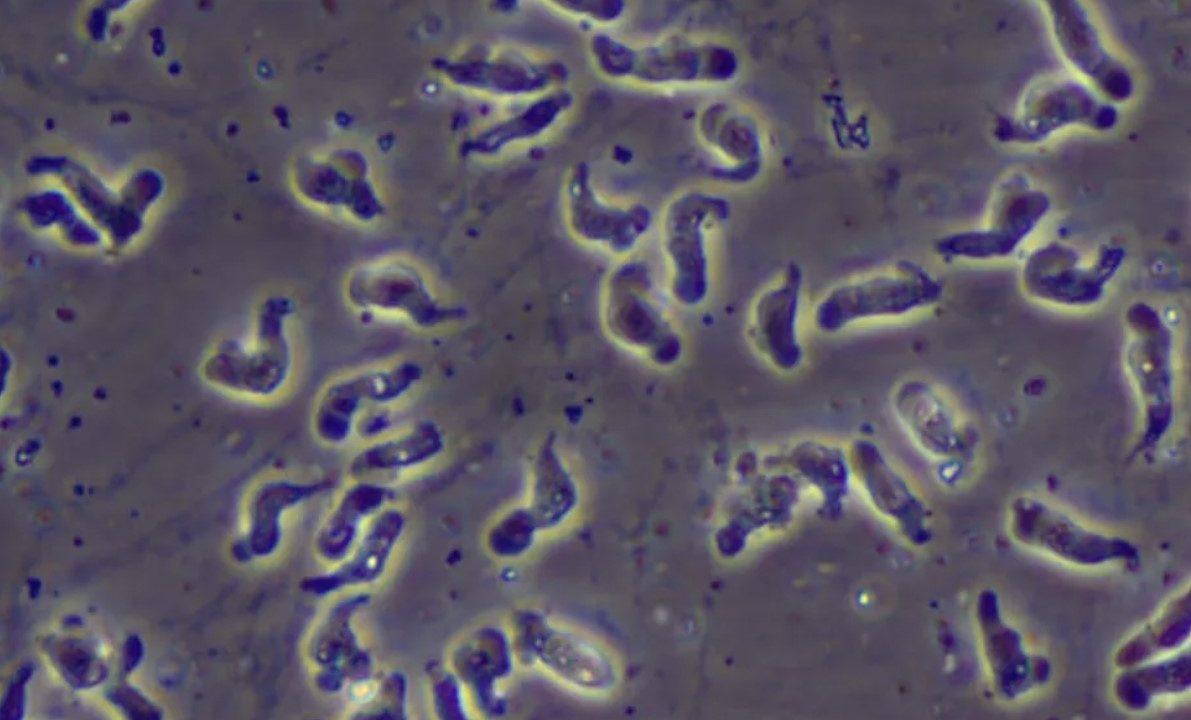 Homem morre ao contrair a ameba ‘comedora de cérebros’ lavando o rosto